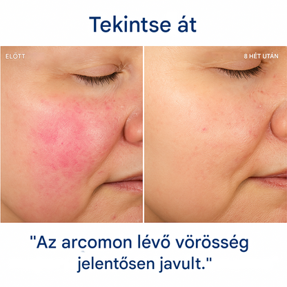 Hydroluxe Premium™ Zuhanyfej – Eltávolítja a klórt és a vízkövet a zuhanyodból. Növeli a víznyomást, miközben vizet takarít meg minden használatkor. 2 extra szűrőt tartalmaz.